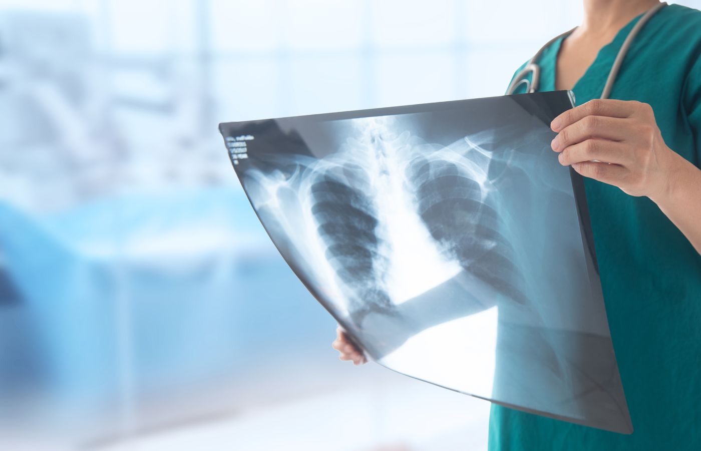 X-rays Help Detect Spine Injuries